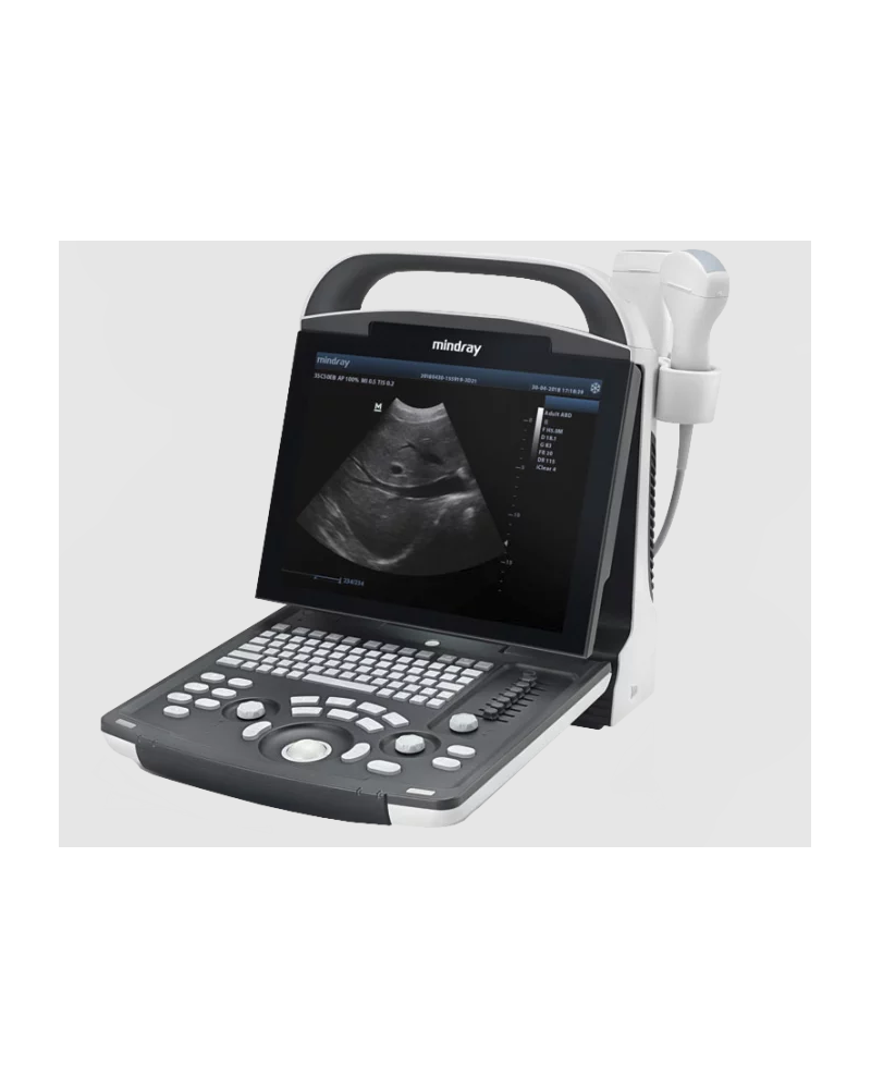 Echographe portable numérique  Mindray, Modèle DP-20
