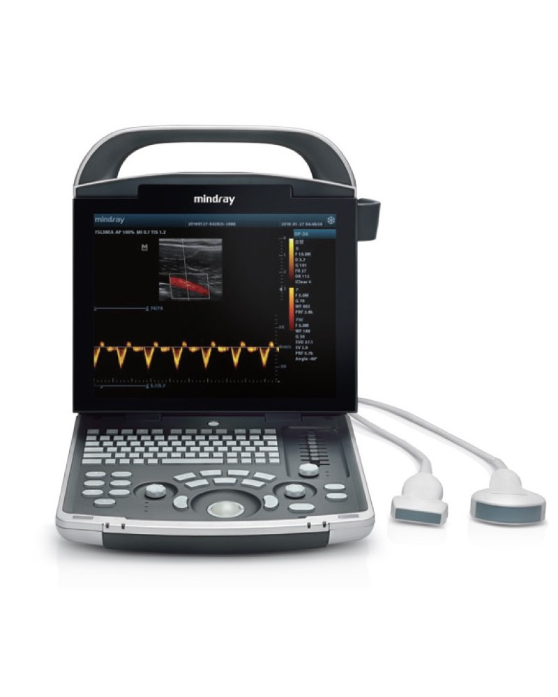 Echographe portable numérique  modèle DP-30 sans accumulateur | sonde convexe (35C50EA)