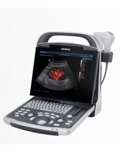 Echographe portable numérique  modèle DP-30 sans accumulateur | sonde convexe (35C50EA)