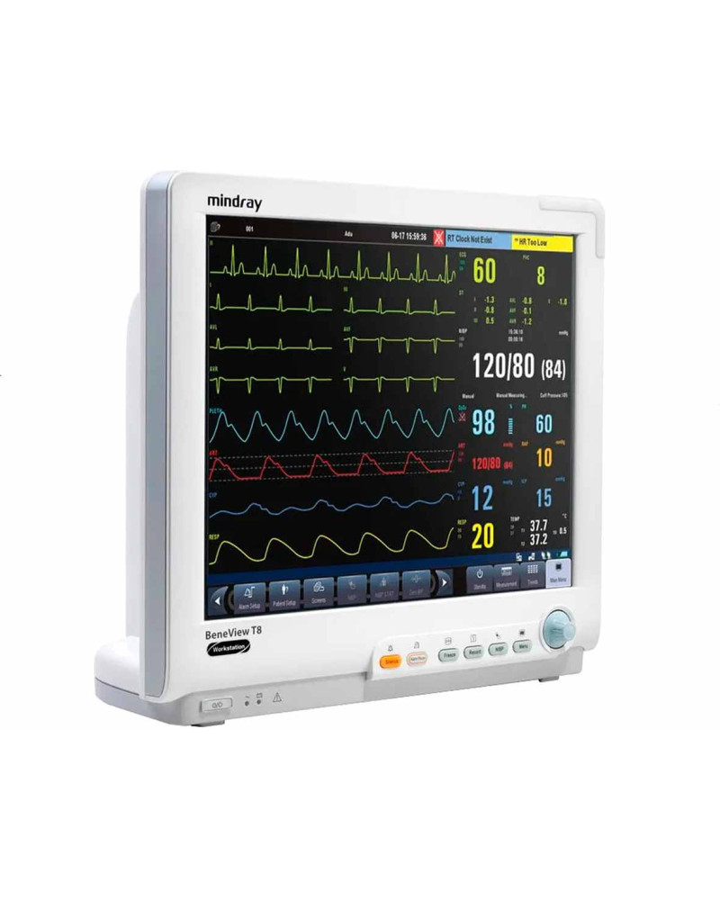Moniteur multiparamètres patient, Modèle BeneView T8