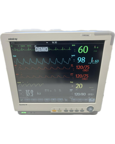 Moniteur multiparamètres patient, Modèle BeneView T8