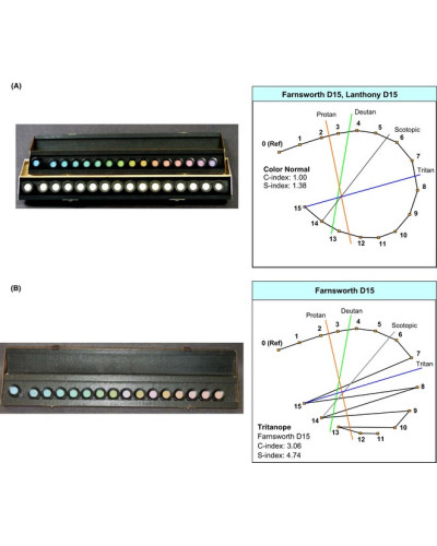 Test de FARNSWORTH 28 HUE