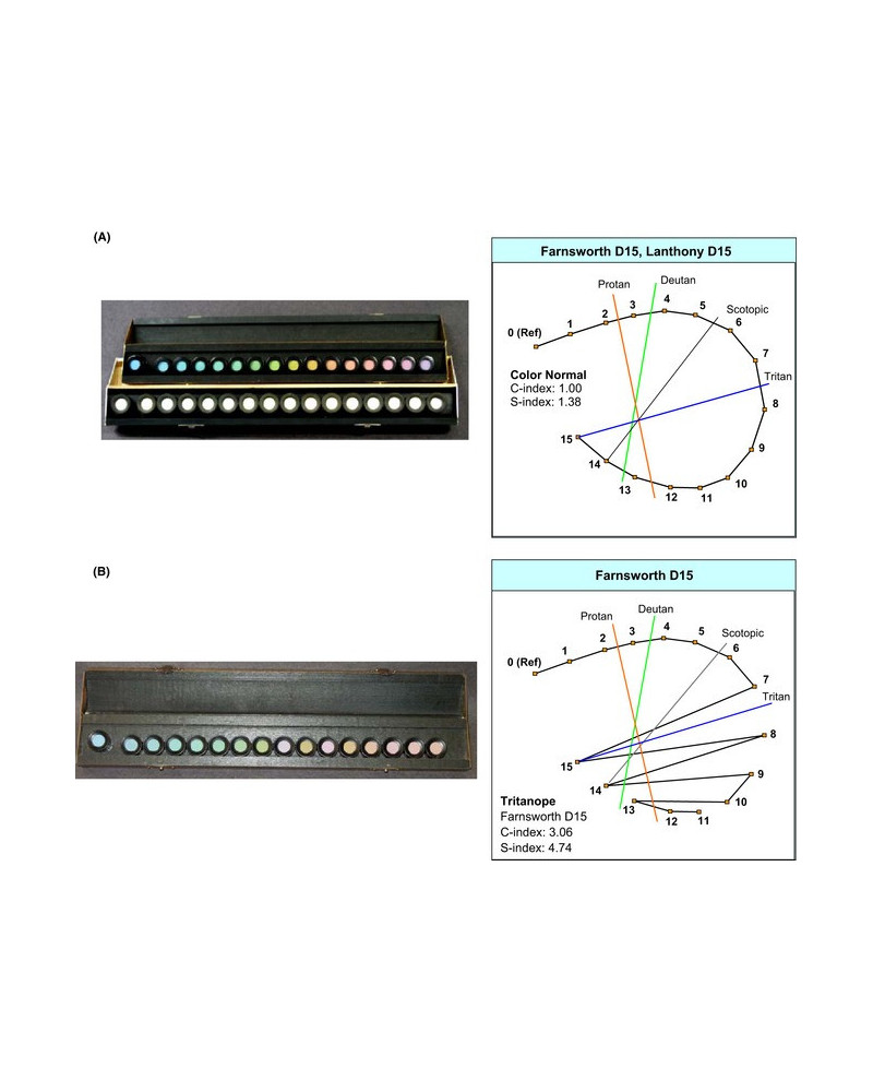 Test de FARNSWORTH 28 HUE Test de FARNSWORTH 28 HUE