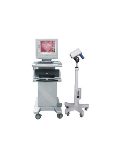 Colposcope vidéo SLC 2000A