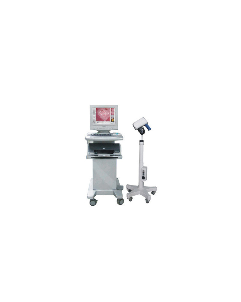 Colposcope vidéo SLC 2000A