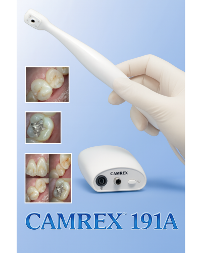 Camera endo-oral camrex