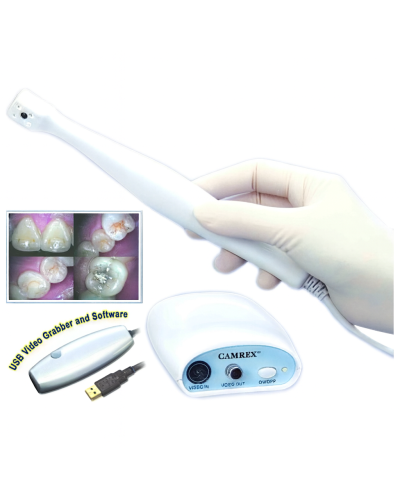 Camera endo-oral camrex