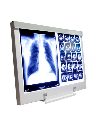 Négatoscope avec variateur, 2 plages