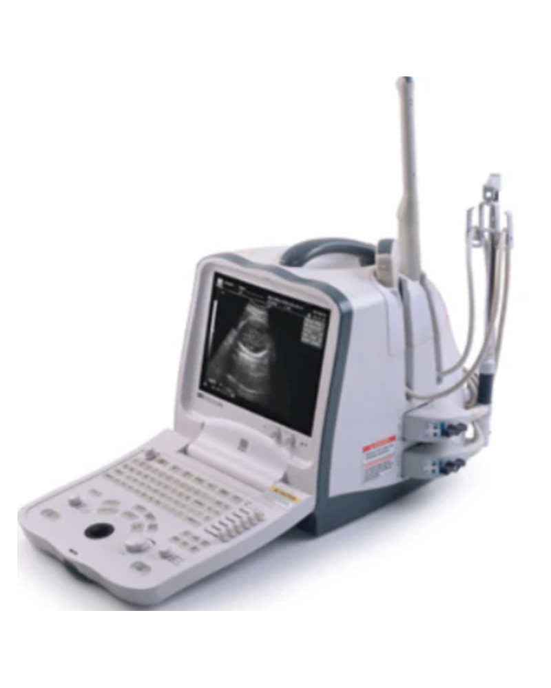 Echographe portable numérique  MINDRAY, Modèle DDP 6600 Echographe portable numérique  MINDRAY, Modèle DDP 6600