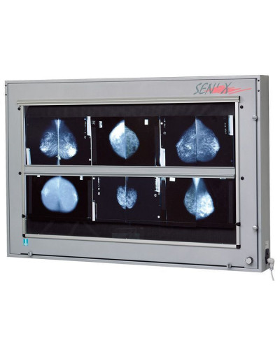 Négatoscope de mammographie 2 radios, 80 x 43 cm
