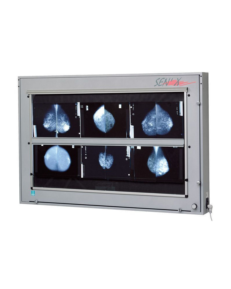 Négatoscope de mammographie 2 radios, 80 x 43 cm