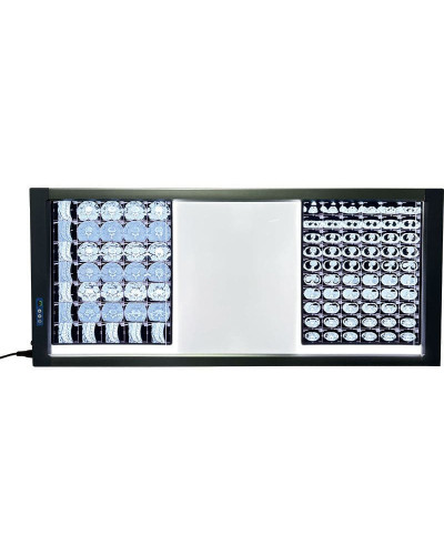 Négatoscope sps-elc 3-radios sur-3 105 x 43 cm