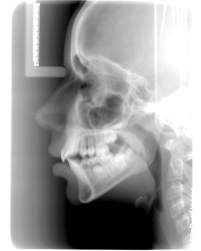 Arcograph Easy IMD - 11