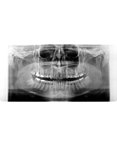 Arcograph Easy IMD - 11