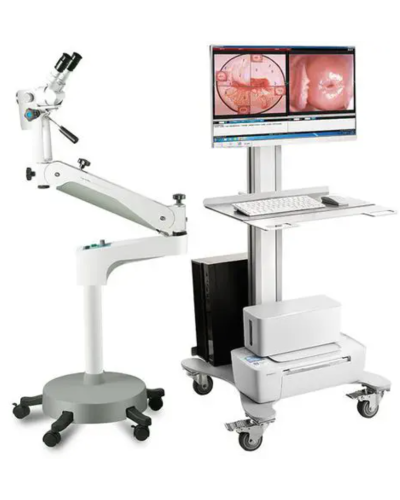 Vidéo colposcope avec bras oscillant