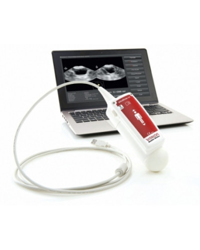 BLADDER SCANNER VITASCAN  AVEC LOGICIEL