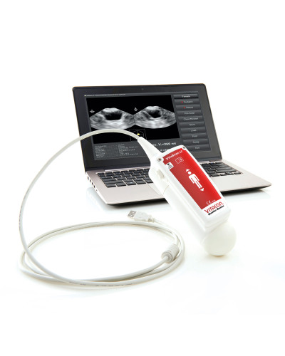 BLADDER SCANNER VITASCAN  AVEC LOGICIEL