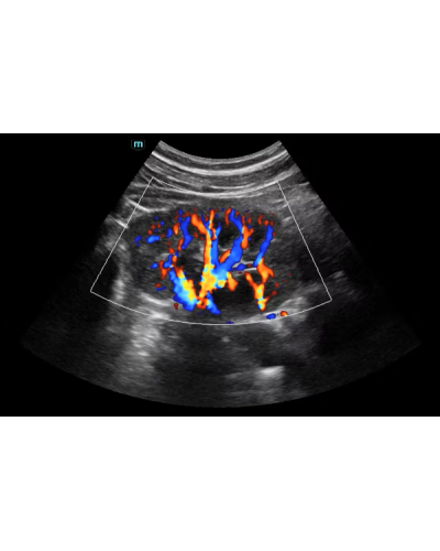 Mindray Consona N6 – Échographe polyvalent haute performance