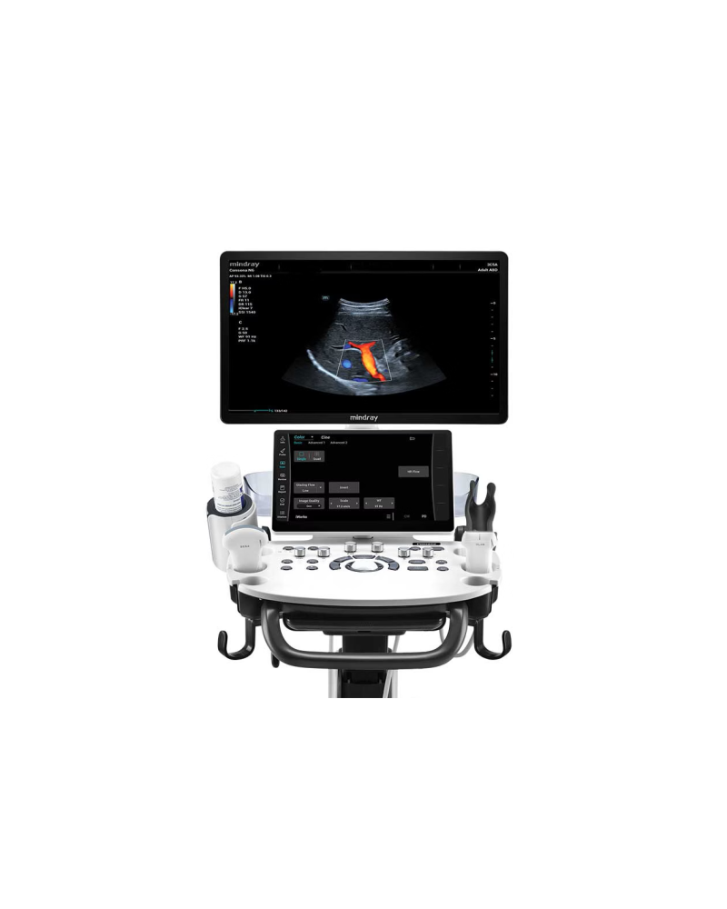 Mindray Consona N6 – Échographe polyvalent haute performance