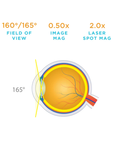 Lentille de VOLK CHAMP LARGE HAUTE RESOLUTION