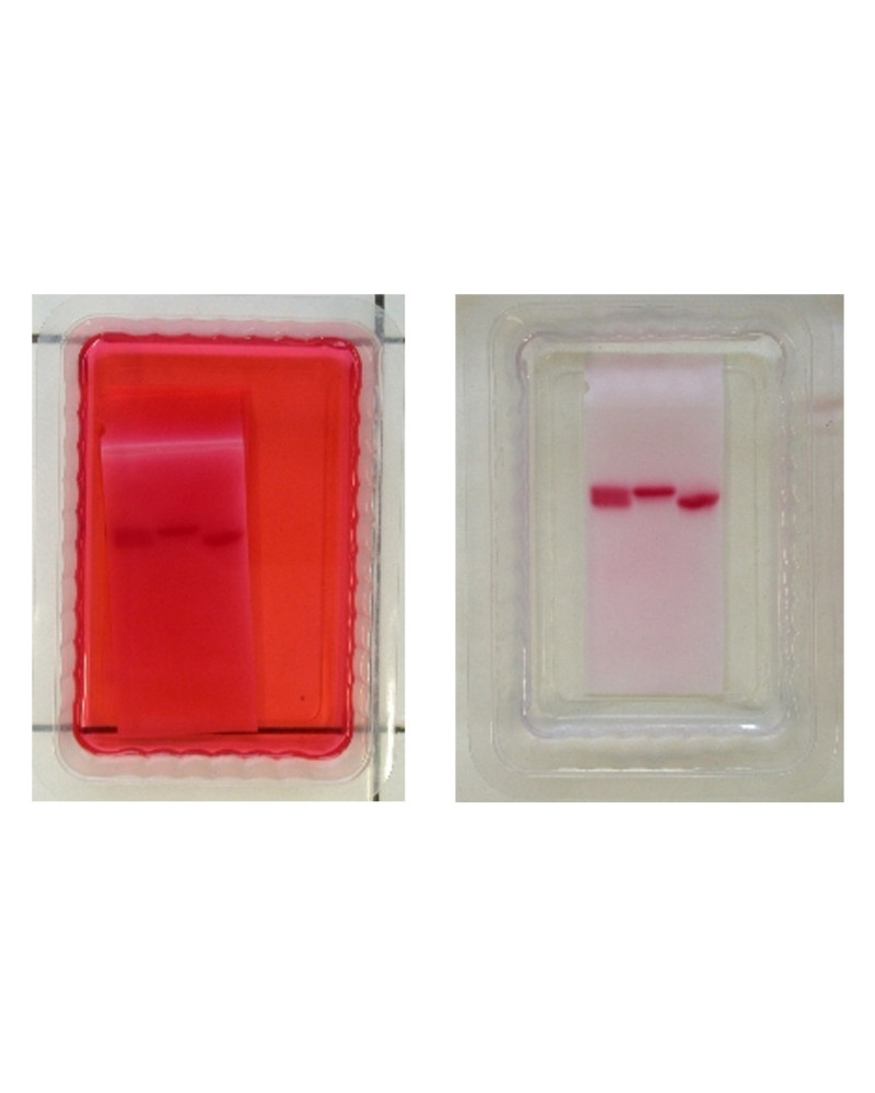 Gels d'acétate de cellulose pour les électrophorèses des lipoprotéines sur MINIPHOR 08/ TS