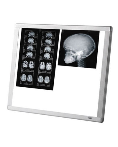 Négatoscope AF200 LED 2 Plages Extra-Plat 7800cd | Socimed