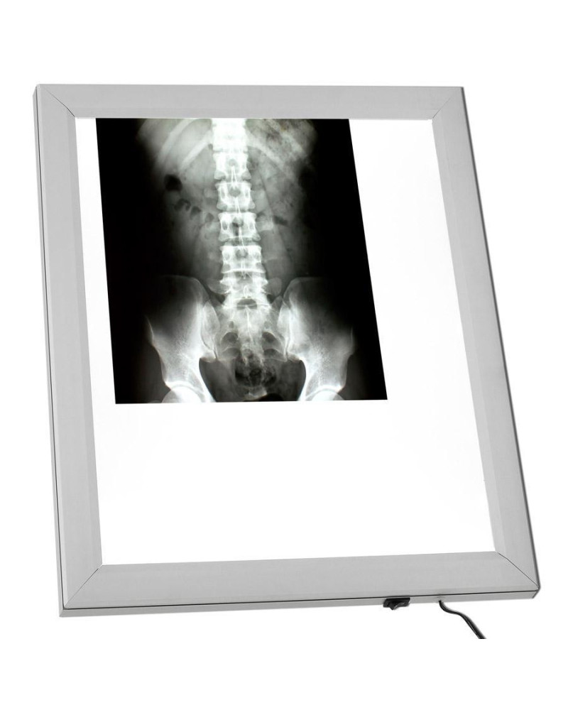 Négatoscope AF300 LED 1 Plage A3 7150cd Extra-Plat | Socimed