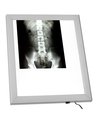 Négatoscope AF400 LED 1 Plage A4 Portable Mural | Socimed