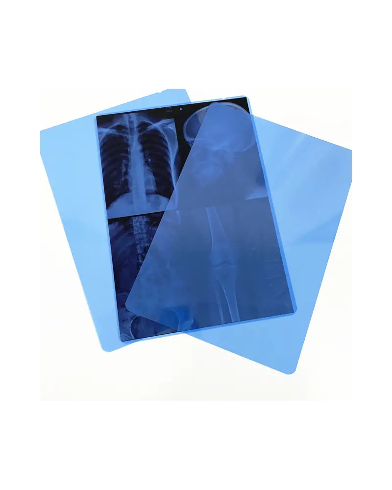 Film Radiographique M dical Bleu 15 X 40 Cm film-radiographique-m-dical-bleu-15-x-40-cm