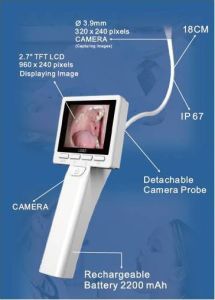 Caméra endoscopique ORL - laryngoscope